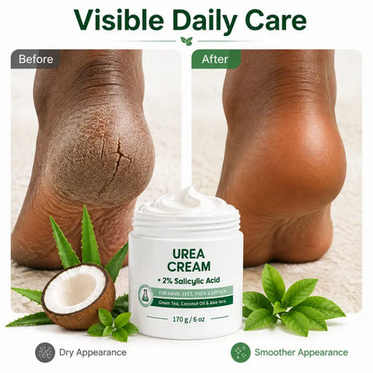 Urea Cream 40 Percent for Feet, Maximum Strength, 6 oz Foot Cream for Dry