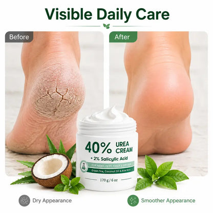 Urea Cream 40 Percent for Feet, Maximum Strength, 6 oz Foot Cream for Dry