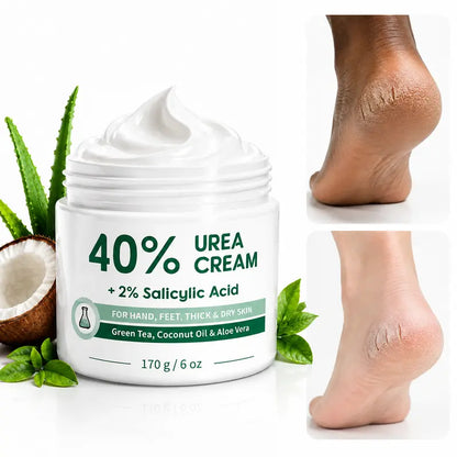 Urea Cream 40 Percent for Feet, Maximum Strength, 6 oz Foot Cream for Dry