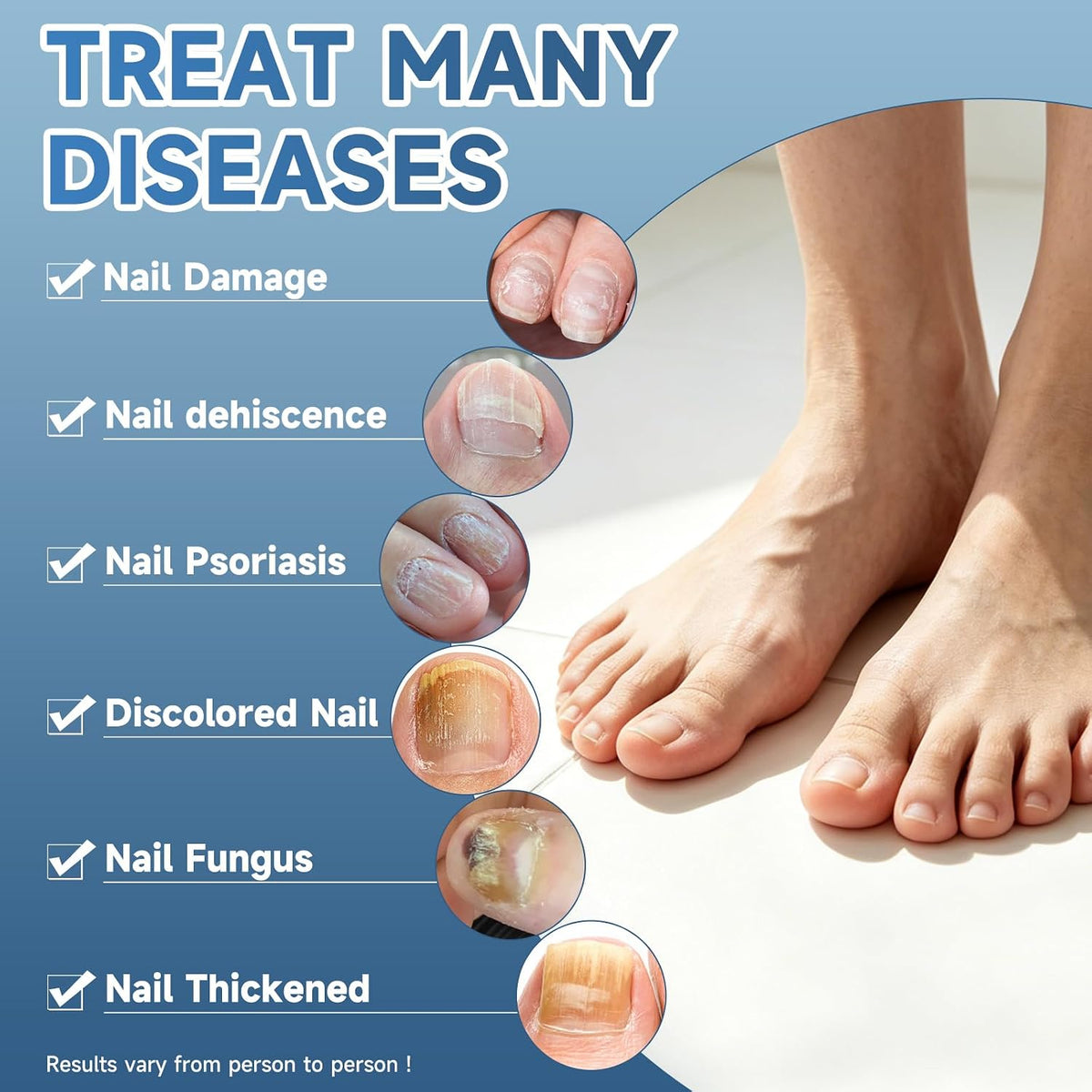 Maximum Strength Nail Fungi Treatment