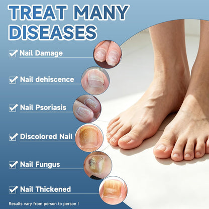 Maximum Strength Nail Fungi Treatment