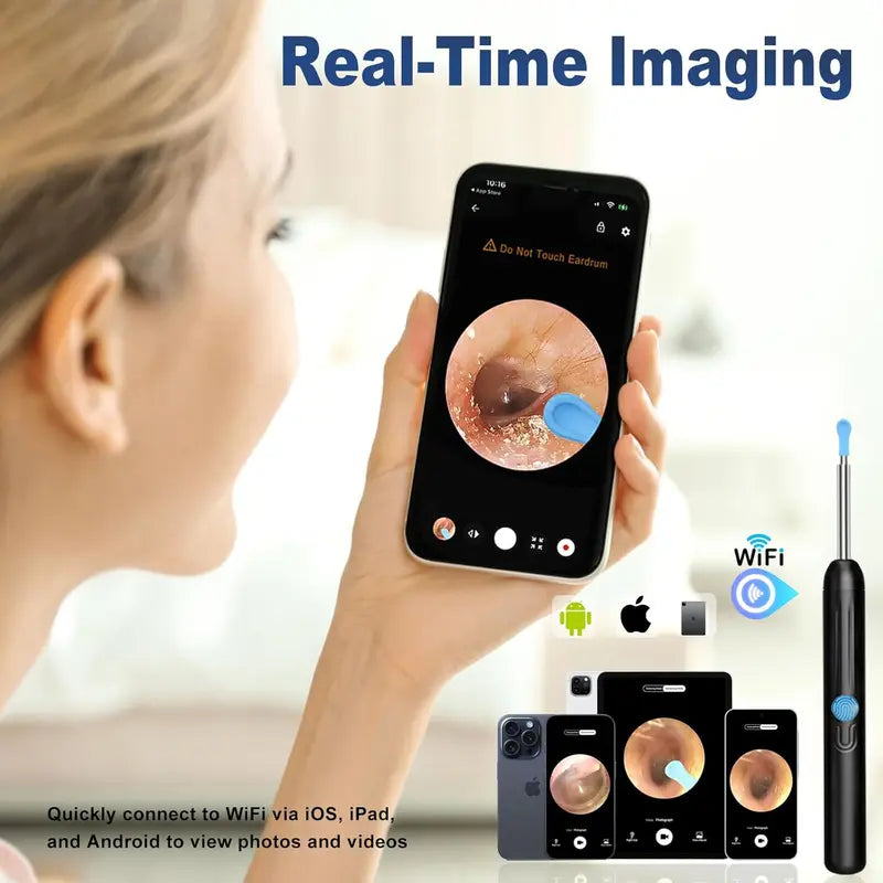 HD Visual Earwax Removal Tool with 1080P Camera