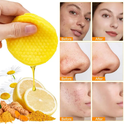 Turmeric & Kojic Acid Deep Cleansing Pads